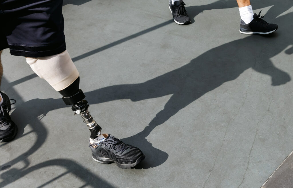 sportivo con protesi