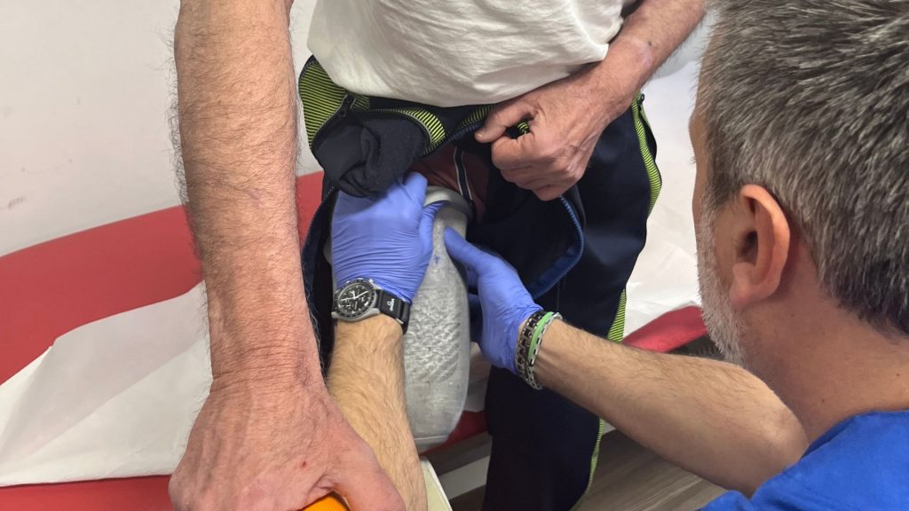Gestione della cuffia per gamba amputata