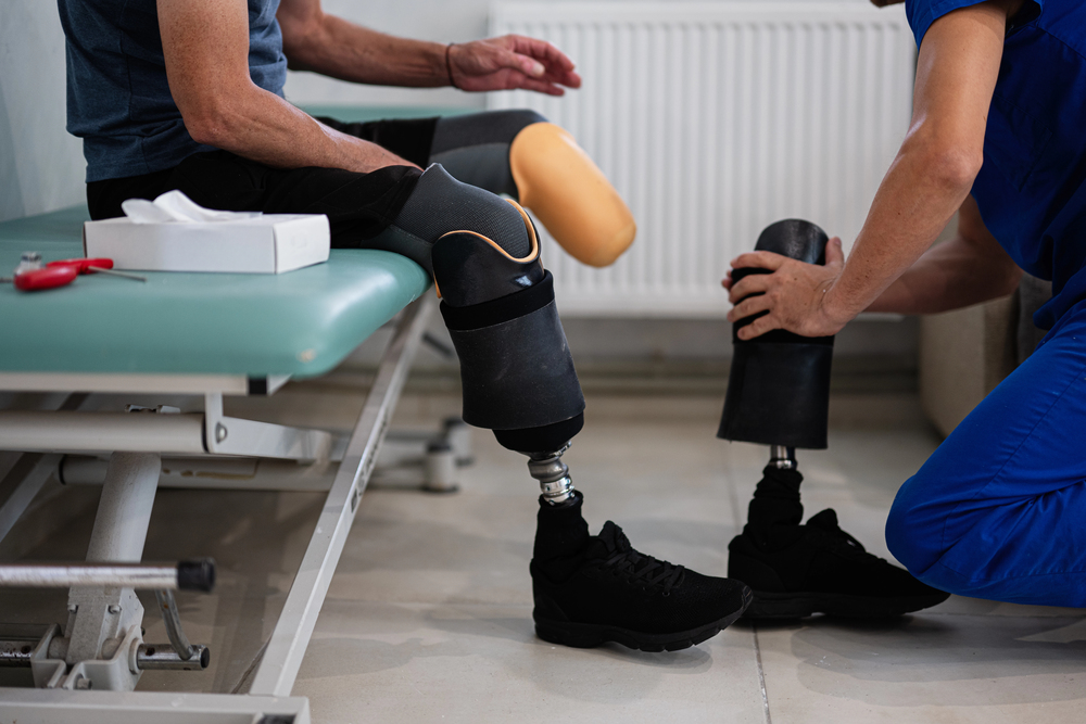 Uomo prova la protesi con l'aiuto di un tecnico specializzato 
