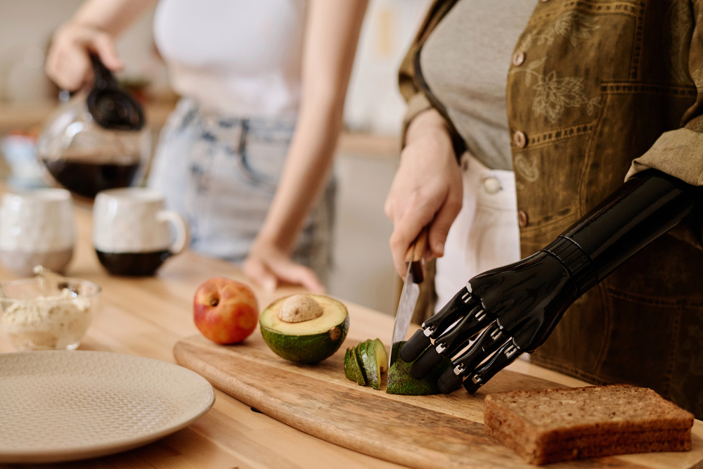 Ragazza con protesi al braccio che taglia un avocado