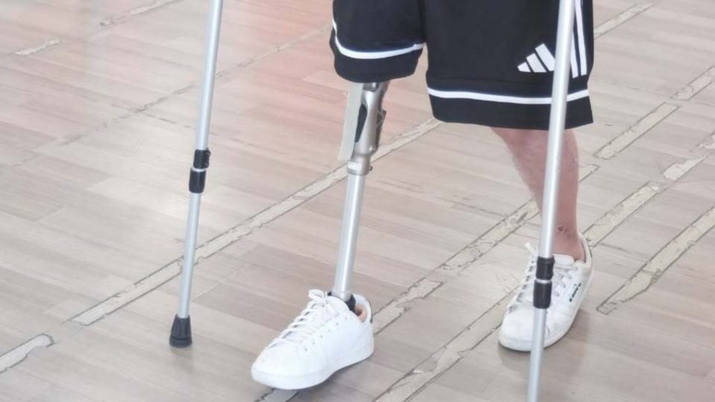 Seduta di riabilitazione per amputati 