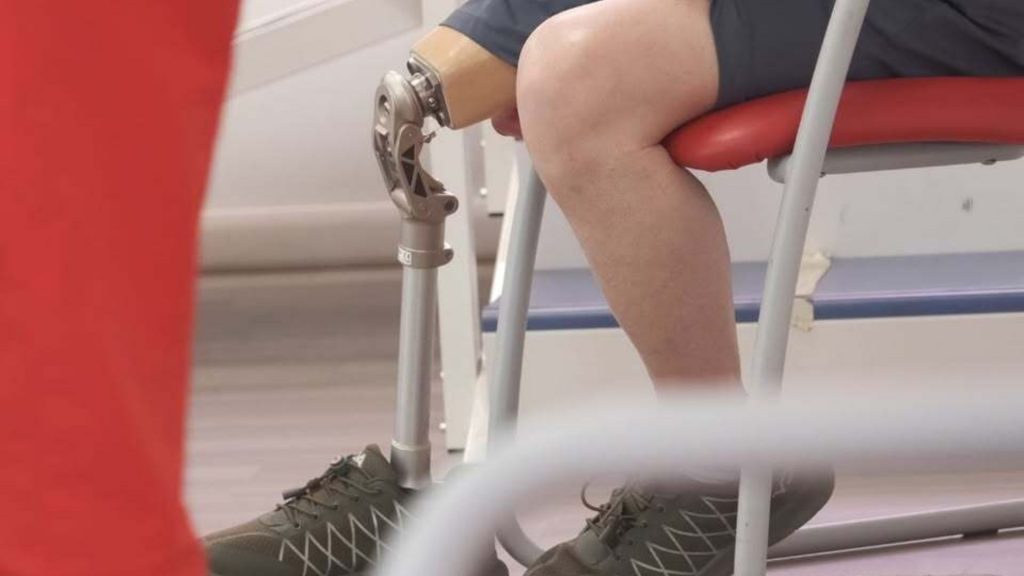 Seduta di riabilitazione per amputati 