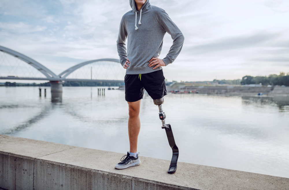 Vivere dopo l’amputazione: adattamento fisico e percezione del corpo