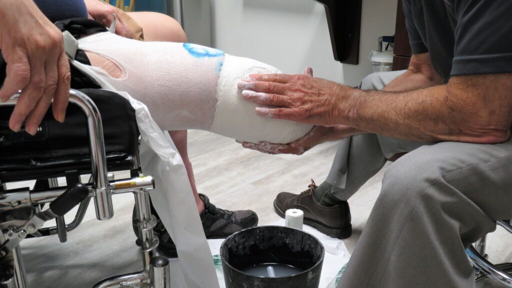 Cura della pelle del moncone: buone pratiche per prevenire irritazioni e complicanze