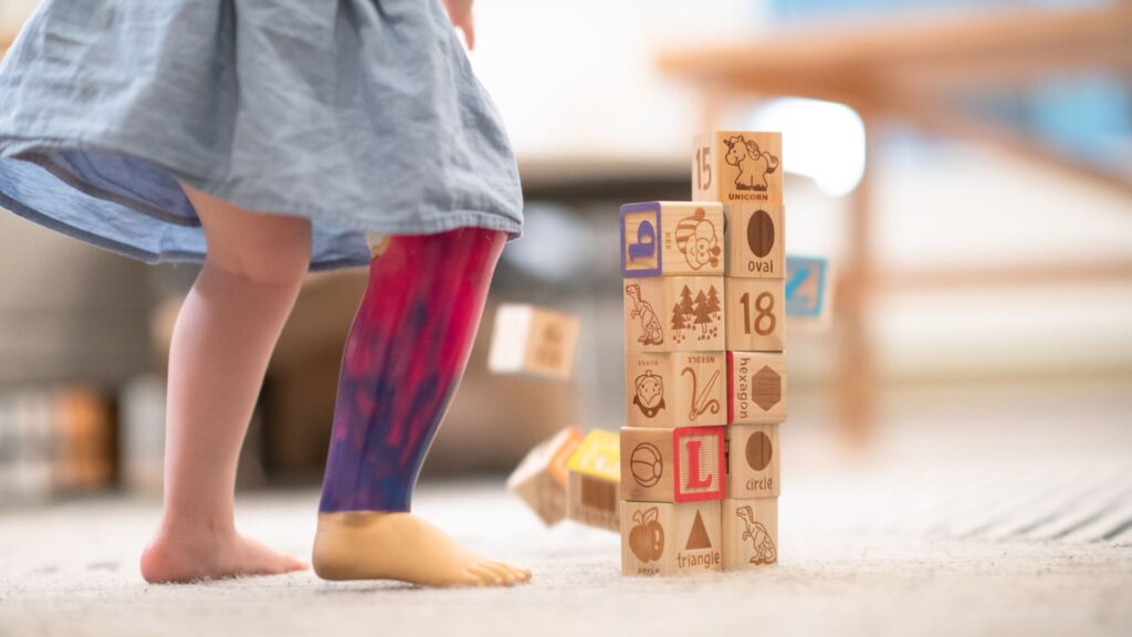 Protesi di arto per bambini: cosa sapere?
